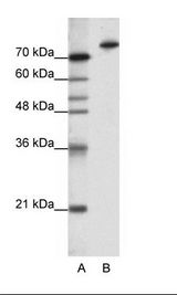 A: Marker, B: HepG2 Cell Lysate