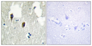IHC of paraffin-embedded human brain tissue, using KLHL3 Antibody. The sample on the right was incubated with synthetic peptide.