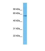 Western blot of Human Breast Tumor. KLHL3 antibody dilution 1.0 ug/ml.