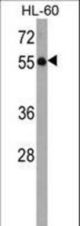 KLHL3 Antibody western blot of HL-60 cell line lysates (35 ug/lane). The KLHL3 antibody detected the KLHL3 protein (arrow).