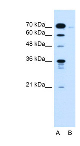 KLHL31 antibody LS-C40480 Western blot of Jurkat lysate.