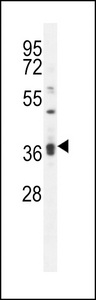 KLHL35 Antibody western blot of MDA-MB231 cell line lysates (35 ug/lane). The KLHL35 antibody detected the KLHL35 protein (arrow).