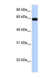 KLHL36 / C16orf44 antibody LS-C101507 Western blot of Fetal Heart lysate.