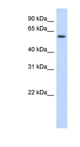 KLHDC5 antibody LS-C102392 Western blot of Transfected 293T cell lysate.