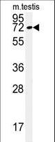 Western blot of KLHL9 Antibody in mouse testis tissue lysates (35 ug/lane). KLHL9 (arrow) was detected using the purified antibody.