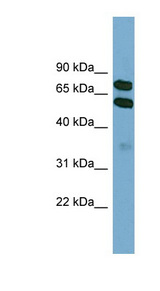 KLHL9 antibody LS-C112021 Western blot of HepG2 cell lysate.