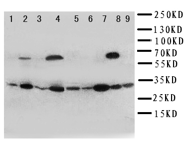 WB of KLK10 / Kallikrein 10 antibody. Lane 1:Rat Ovary Tissue Lysate. Lane2: Rat Testis Tissue Lysate. Lane3: Rat Spleen Tissue Lysate. Lane4: Rat Liver Tissue Lysate. Lane 5: 22RV Cell Lysate. Lane 6: SROV Cell Lysate . Lane 7: HELA Cell Lysate. Lane8: MCF-7 Cell Lysate. Lane9: M231 Cell Lysate.