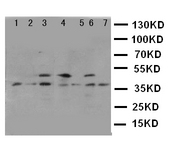 WB of KLK11 / Kallikrein 11 antibody. Lane 1: U87 Cell Lysate. Lane 2: A549 Cell Lysate. Lane 3: HELA Cell Lysate. Lane 4: M231 Cell Lysate. Lane 5: M453 Cell Lysate. Lane 6: COLO320 Cell Lysate. Lane 7: JURKAT Cell Lysate.