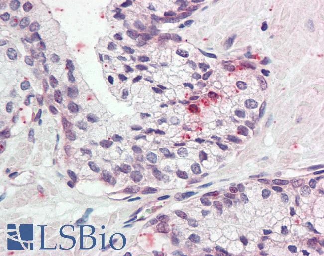Anti-KLK11 / Kallikrein 11 antibody IHC of human prostate. Immunohistochemistry of formalin-fixed, paraffin-embedded tissue after heat-induced antigen retrieval. Antibody LS-B2310 concentration 5 ug/ml.