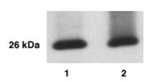 KLK12 Antibody - Western Blot of KLK12 in prostate cancer cell line LNCaP(10) and breast cancer cell line BT-474(2) with anti-KLK12 at a dilution of 1:1000