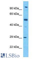 KLK13 / Kallikrein 13 antibody Western Blot of Esophagus Tumor. Antibody dilution: 1 ug/ml.