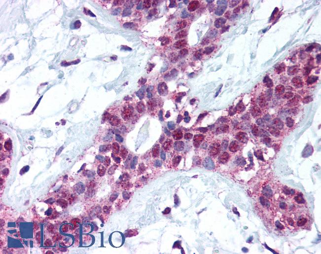 Anti-Kallikrein 13 antibody IHC of human breast. Immunohistochemistry of formalin-fixed, paraffin-embedded tissue after heat-induced antigen retrieval. Antibody LS-B524 concentration 2.5 ug/ml.
