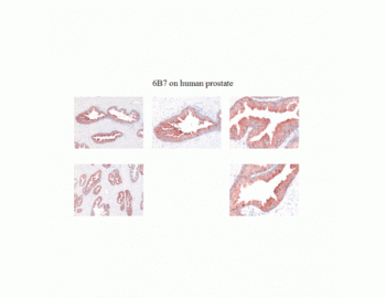Immunohistochemistry of KLK2 antibody LS-C82331.