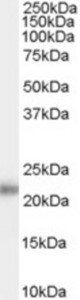 Antibody (0.1 ug/ml) staining of Human Prostate lysate (35 ug protein in RIPA buffer). Primary incubation was 1 hour. Detected by chemiluminescence.