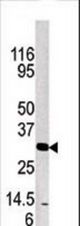 Western blot of anti-KLK3 antibody in mouse brain tissue lysate.KLK3(arrow) was detected using the purified antibody.