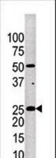 Western blot of anti-KLK4 antibody in mouse brain tissue lysate.KLK4(arrow) was detected using the purified antibody.