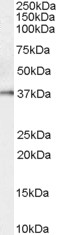 Antibody (0.1 ug/ml) staining of Human Prostate lysate (35 ug protein in RIPA buffer). Primary incubation was 1 hour. Detected by chemiluminescence.