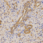 Immunohistochemistry of paraffin-embedded rat kidney tissue using KLK5 antibody at dilution of 1:200 (x400 lens).