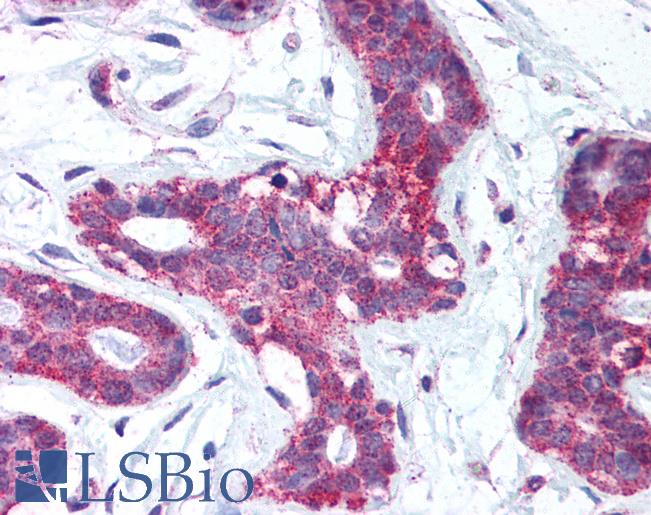 Anti-KLK5 / Kallikrein 5 antibody IHC of human breast. Immunohistochemistry of formalin-fixed, paraffin-embedded tissue after heat-induced antigen retrieval. Antibody LS-B525 concentration 2.5 ug/ml.