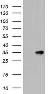 HEK293T cells were transfected with the pCMV6-ENTRY control (Left lane) or pCMV6-ENTRY KLK8 (Right lane) cDNA for 48 hrs and lysed. Equivalent amounts of cell lysates (5 ug per lane) were separated by SDS-PAGE and immunoblotted with anti-KLK8.