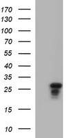 HEK293T cells were transfected with the pCMV6-ENTRY control (Left lane) or pCMV6-ENTRY KLK8 (Right lane) cDNA for 48 hrs and lysed. Equivalent amounts of cell lysates (5 ug per lane) were separated by SDS-PAGE and immunoblotted with anti-KLK8.