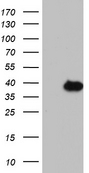 HEK293T cells were transfected with the pCMV6-ENTRY control (Left lane) or pCMV6-ENTRY KLK8 (Right lane) cDNA for 48 hrs and lysed. Equivalent amounts of cell lysates (5 ug per lane) were separated by SDS-PAGE and immunoblotted with anti-KLK8.