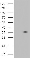 HEK293T cells were transfected with the pCMV6-ENTRY control (Left lane) or pCMV6-ENTRY KLK8 (Right lane) cDNA for 48 hrs and lysed. Equivalent amounts of cell lysates (5 ug per lane) were separated by SDS-PAGE and immunoblotted with anti-KLK8.