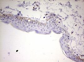 IHC of paraffin-embedded Human skin tissue using anti-KLK8 mouse monoclonal antibody. (Heat-induced epitope retrieval by 10mM citric buffer, pH6.0, 120°C for 3min).