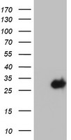 HEK293T cells were transfected with the pCMV6-ENTRY control (Left lane) or pCMV6-ENTRY KLK8 (Right lane) cDNA for 48 hrs and lysed. Equivalent amounts of cell lysates (5 ug per lane) were separated by SDS-PAGE and immunoblotted with anti-KLK8.