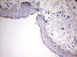 IHC of paraffin-embedded Human skin tissue using anti-KLK8 mouse monoclonal antibody. (Heat-induced epitope retrieval by 10mM citric buffer, pH6.0, 120°C for 3min).