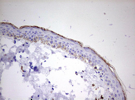 IHC of paraffin-embedded Human skin tissue using anti-KLK8 mouse monoclonal antibody. (Heat-induced epitope retrieval by 10mM citric buffer, pH6.0, 120°C for 3min).