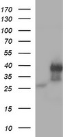 HEK293T cells were transfected with the pCMV6-ENTRY control (Left lane) or pCMV6-ENTRY KLK8 (Right lane) cDNA for 48 hrs and lysed. Equivalent amounts of cell lysates (5 ug per lane) were separated by SDS-PAGE and immunoblotted with anti-KLK8.