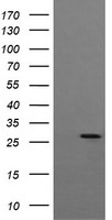 HEK293T cells were transfected with the pCMV6-ENTRY control (Left lane) or pCMV6-ENTRY KLK8 (Right lane) cDNA for 48 hrs and lysed. Equivalent amounts of cell lysates (5 ug per lane) were separated by SDS-PAGE and immunoblotted with anti-KLK8.