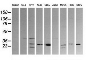 Western blot of extracts (35ug) from 9 different cell lines by using anti-KLK8 monoclonal antibody (HepG2: human; HeLa: human; SVT2: mouse; A549: human; COS7: monkey; Jurkat: human; MDCK: canine; PC12: rat; MCF7: human).