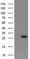 HEK293T cells were transfected with the pCMV6-ENTRY control (Left lane) or pCMV6-ENTRY KLK8 (Right lane) cDNA for 48 hrs and lysed. Equivalent amounts of cell lysates (5 ug per lane) were separated by SDS-PAGE and immunoblotted with anti-KLK8.