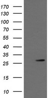 HEK293T cells were transfected with the pCMV6-ENTRY control (Left lane) or pCMV6-ENTRY KLK8 (Right lane) cDNA for 48 hrs and lysed. Equivalent amounts of cell lysates (5 ug per lane) were separated by SDS-PAGE and immunoblotted with anti-KLK8.