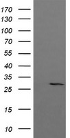 HEK293T cells were transfected with the pCMV6-ENTRY control (Left lane) or pCMV6-ENTRY KLK8 (Right lane) cDNA for 48 hrs and lysed. Equivalent amounts of cell lysates (5 ug per lane) were separated by SDS-PAGE and immunoblotted with anti-KLK8.