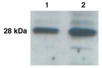 KLK L3 (KLK9) Antibody - Western Blot of KLK-L3 in cancer cell lines LnNCap(lane 1) and BT-474(lane 2) with anti-KLK-L3 at 1:1,000 dilution