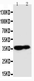 WB of KLK9 / Kallikrein 9 antibody. All lanes: Anti-KLK9 at 0.5ug/ml. Lane 1: MCF-7 Whole Cell Lysate at 40ug. Lane 2: A431 Whole Cell Lysate at 40ug. Predicted bind size: 28KD. Observed bind size: 40KD.