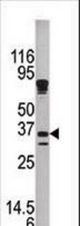 Western blot of anti-KLK9 antibody in mouse brain tissue lysate.KLK9(arrow) was detected using the purified antibody.