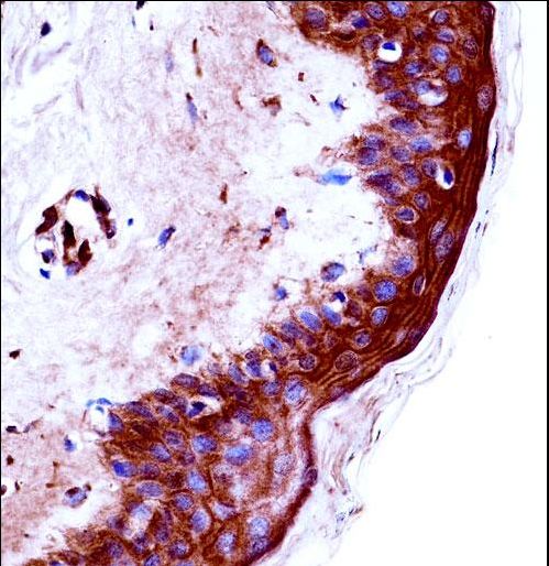 KLK9 Antibody immunohistochemistry of formalin-fixed and paraffin-embedded human skin tissue followed by peroxidase-conjugated secondary antibody and DAB staining.