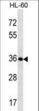 KLK9 Antibody western blot of HL-60 cell line lysates (35 ug/lane). The KLK9 antibody detected the KLK9 protein (arrow).