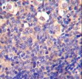 KLRC2 Antibody immunohistochemistry of formalin-fixed and paraffin-embedded human tonsillitis tissue followed by peroxidase-conjugated secondary antibody and DAB staining.