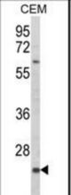 Western blot of KLRC2 Antibody in CEM cell line lysates (35 ug/lane). KLRC2 (arrow) was detected using the purified antibody.