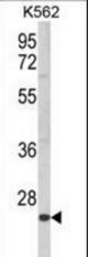 Western blot of KLRC2 Antibody in K562 cell line lysates (35 ug/lane). KLRC2 (arrow) was detected using the purified antibody.