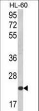 Western blot of KLRC2 Antibody in HL-60 cell line lysates (35 ug/lane). KLRC2 (arrow) was detected using the purified antibody.