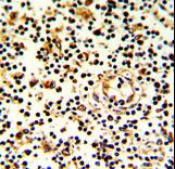Formalin-fixed and paraffin-embedded human lymph with KLRD1 Antibody , which was peroxidase-conjugated to the secondary antibody, followed by DAB staining. This data demonstrates the use of this antibody for immunohistochemistry; clinical relevance has not been evaluated.