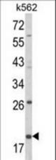Western blot of KLRD1 Antibody in K562 cell line lysates (35 ug/lane). KLRD1 (arrow) was detected using the purified antibody.