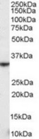KLRK1 antibody staining (0.3 ug/ml) of human spleen lysate (RIPA buffer, 35g total protein per lane). Primary incubated for 1 hour. Detected by Western blot of chemiluminescence.