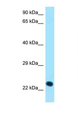 KLRK1 / NKG2D antibody LS-C146470 Western blot of 435S Cell lysate. Antibody concentration 1 ug/ml.